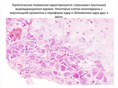 Гepпeсвирусная пневмония (Гepпeсновирусная инфекция у черепах)