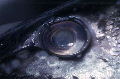 Катаpaкта глаза (Диплостоматоз)