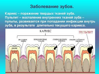 Болезни зубов у собак: зубной камень, кариес, периодонтит, пульпит