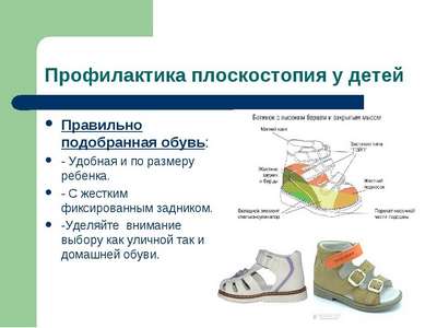 Что нужно знать при покупке детской ортопедической обуви - профилактика и коррекция плоскостопия