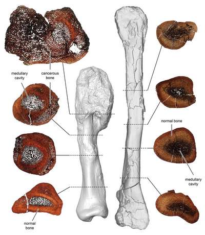 У динозавра впервые обнаружили paковую опухоль - остеосаркому