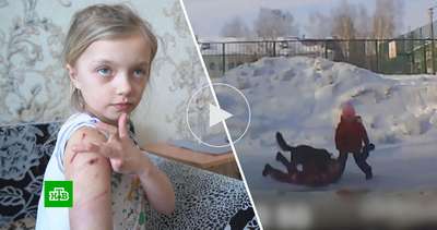На Львовщине бешеный кот атаковал 10-летнего ребенка